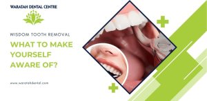 Wisdom Tooth Removal