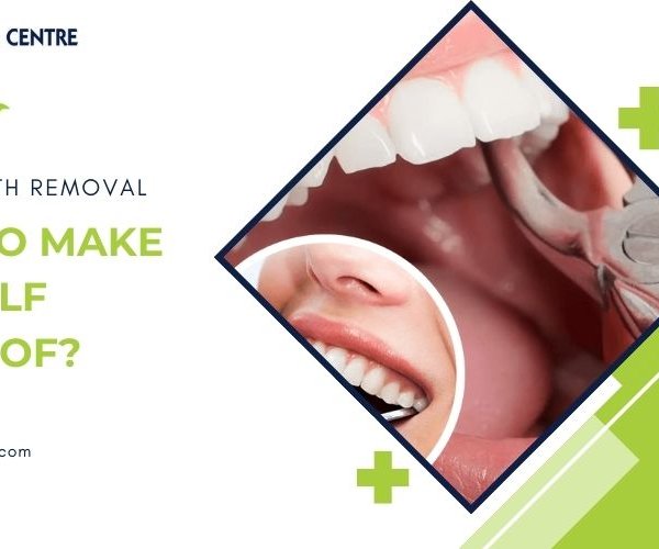 Wisdom Tooth Removal