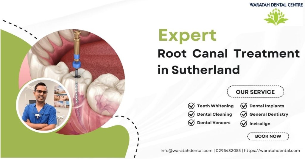 Root Canal Treatment in Sutherland
