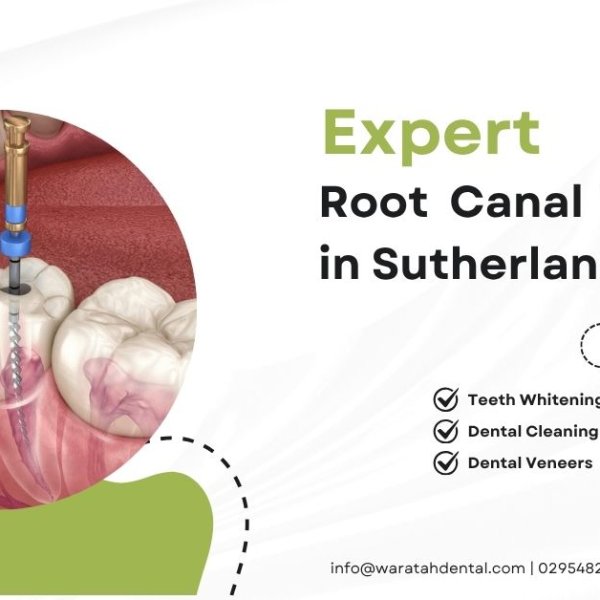 Root Canal Treatment in Sutherland
